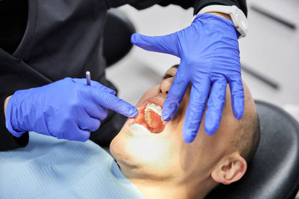 Best Emergency Root Canal Therapy in Iola, KS