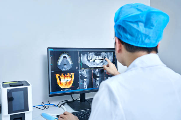 Best Knocked-Out Tooth (Avulsed Tooth) Treatment in Iola, KS